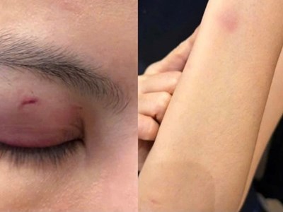 Vụ Trung Quân Idol nghi hành hung bác sĩ: Người tố cáo bị thương thế nào?