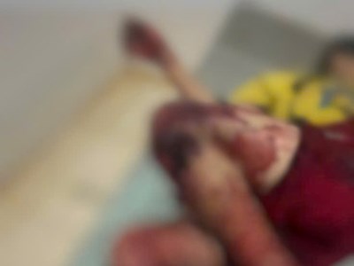  4 học sinh bị thương vì tự chế tạo pháo nổ