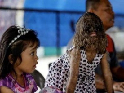 Cô bé “người sói” hiện ra sao?