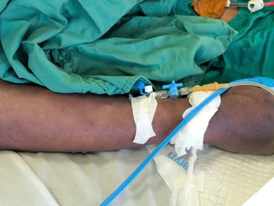 Nghi ăn lòng lợn, người đàn ông nhập viện nguy kịch