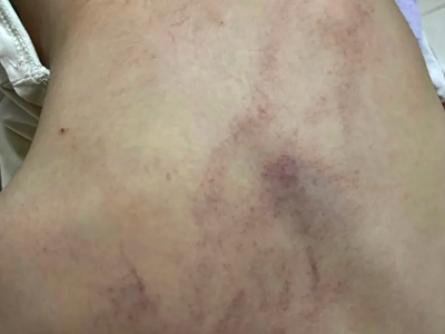 Tổng đài bảo vệ trẻ em 111 vào cuộc vụ nghi bạo hành trẻ em ở phường Bồ Đề