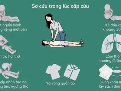 4 việc cần làm và 5 việc cần tránh khi sơ cứu người đột quỵ tại nhà