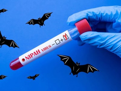 Bác sĩ Bệnh viện Bạch Mai nói thẳng về virus Nipah