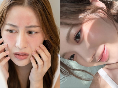 Da sạm nắng, sụt giảm collagen dù bôi kem chống nắng đầy đủ? Bác sĩ da liễu chỉ 5 lỗi sai cần tránh vào mùa hè
