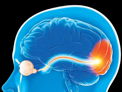 Võng mạc nhân tạo