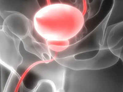 Hé lộ cơ chế hình thành ung thư tuyến tiền liệt