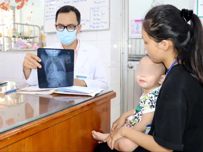 Gắp thành công kim băng ghim vào thực quản của trẻ một tuổi