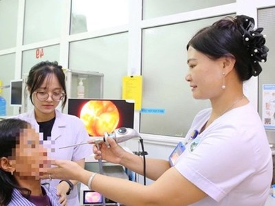 Phát hiện ổ giòi trong hốc mũi của nữ bệnh nhân