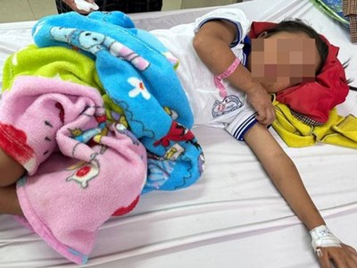 Cháu bé 7 tuổi nhập viện với 200 vết ong đốt gây bội nhiễm, tổn thương giác mạc