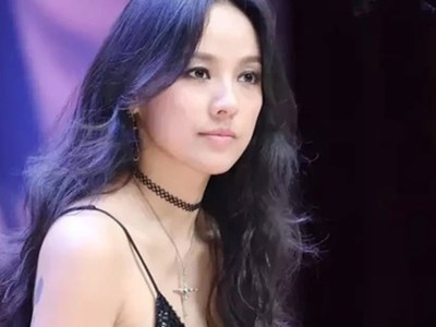 Nữ ca sĩ nổi tiếng bị thương dẫn đến biến dạng ngón tay