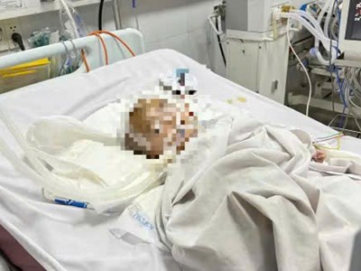 Bé trai xuất huyết não bất thường tại cơ sở giữ trẻ tự phát