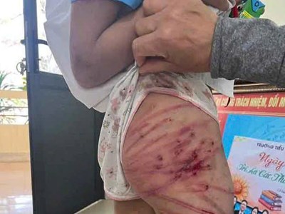 Các vụ bạo hành trẻ em gần đây gây bức xúc dư luận