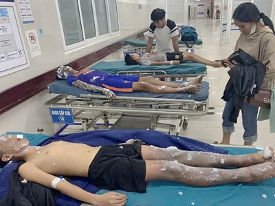 Bốn thiếu niên bị bỏng nặng vì làm pháo nổ theo hướng dẫn trên mạng