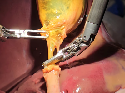 Robot trở thành bác sĩ phẫu thuật lành nghề