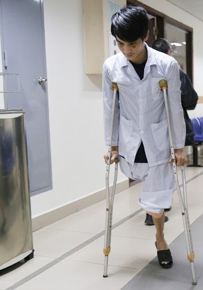 Chàng trai Hemophilia và ước mơ giữ chiếc chân còn lại - Anh 2