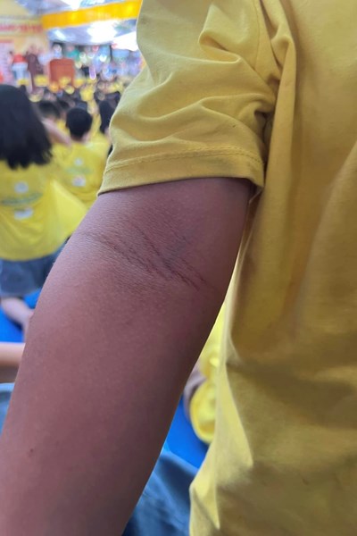 Vụ khoá tu hè tại chùa Cự Đà: Người mẹ đồng ý hoà giải - Anh 2