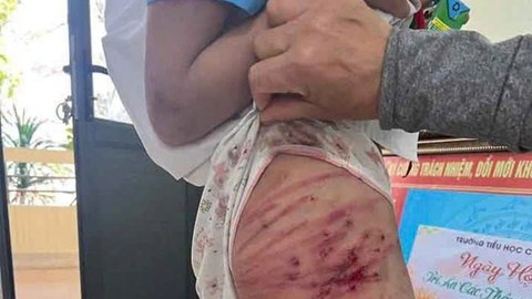 Các vụ bạo hành trẻ em gần đây gây bức xúc dư luận