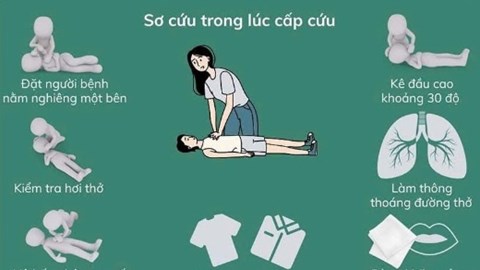 4 việc cần làm và 5 việc cần tránh khi sơ cứu người đột quỵ tại nhà