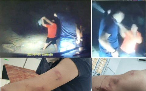 Khởi tố 2 đối tượng dùng cuốc sắt hành hung phóng viên trong đêm - Anh 3