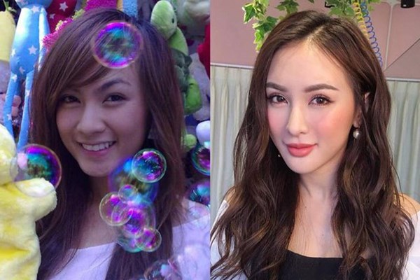 Trào lưu “dao kéo” khiến mỹ nhân Việt ngày càng khó phân biệt đến ngỡ ngàng - Anh 10