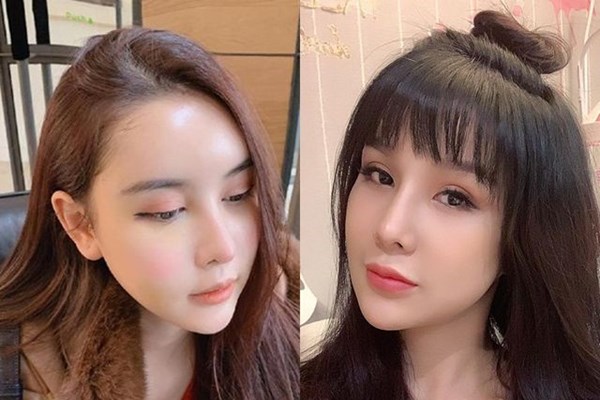 Trào lưu “dao kéo” khiến mỹ nhân Việt ngày càng khó phân biệt đến ngỡ ngàng - Anh 16