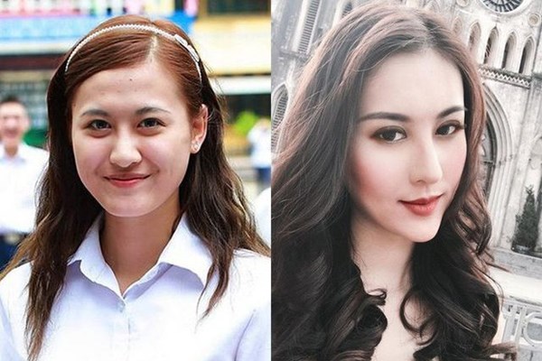 Trào lưu “dao kéo” khiến mỹ nhân Việt ngày càng khó phân biệt đến ngỡ ngàng - Anh 17