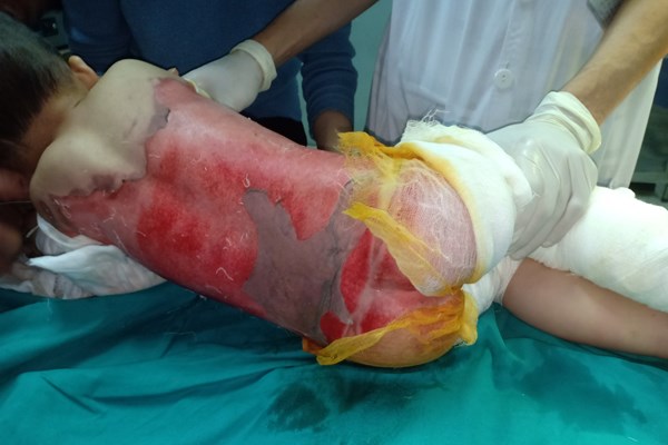 Cha mẹ chủ quan, con trẻ lãnh đủ - Anh 1