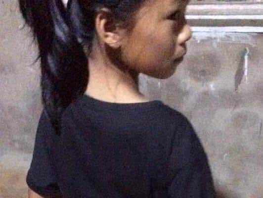 Nghi ăn trộm tiền, công an viên đánh cháu bé thâm tím người - Anh 1