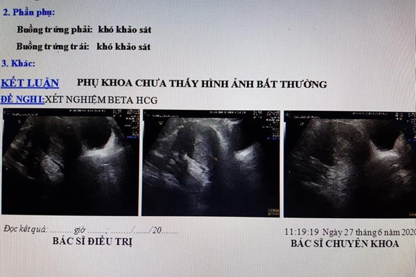 Đến viện chờ sinh, sản phụ mới biết mình không hề mang thai - Anh 1