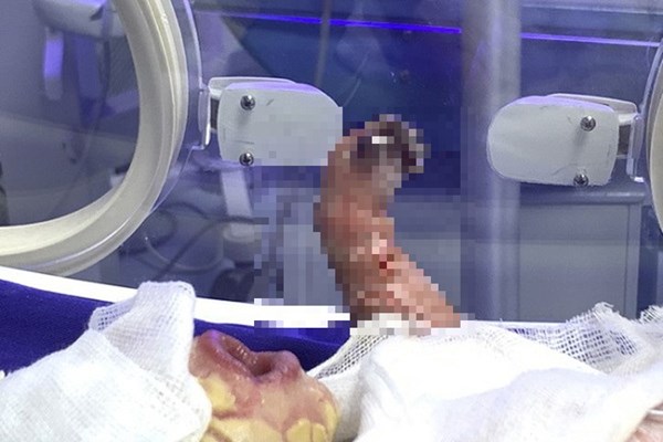 Sẽ gửi mẫu phân tích gen bố mẹ của bé sơ sinh mắc bệnh da vảy cá hiếm gặp - Anh 1