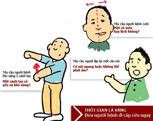 20 ngày tiếp nhận 750 bệnh nhân đột quỵ - Anh 2