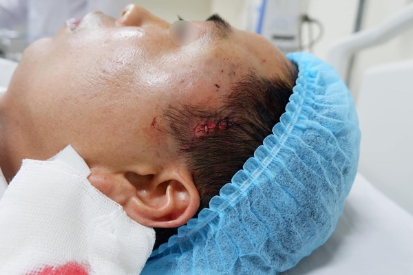 Phẫu thuật thẩm mỹ ở cơ sở tư nhân: “Chữa cháy” ở bệnh viện - Anh 1
