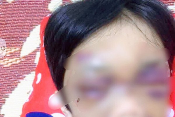Khởi tố người mẹ hành hạ dã man con gái 6 tuổi - Anh 1