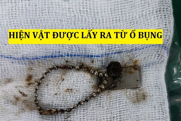 Phòng tránh tai nạn thương tích cho trẻ: “Chúng tôi tiếp tục cảnh báo phụ huynh hãy cẩn thận hơn nữa” - Anh 2