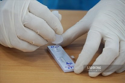 Thêm 24 ca nhiễm SARS-CoV-2 mới, 17 ca ghi nhận tại Bệnh viện Phổi Hà Nội - Anh 1