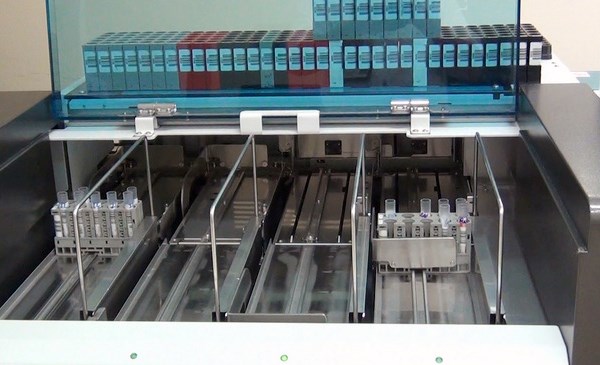 Xét nghiệm định lượng kháng thể sau khi tiêm vắc xin ngừa Covid-19 - Anh 1
