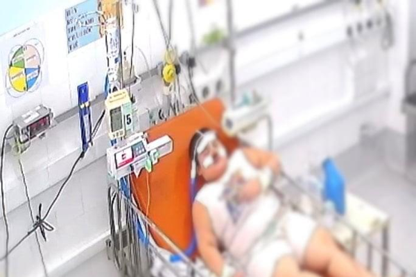Nhiểu trẻ dư cân, béo phì mắc Covid-19: Suy hô hấp nặng nhưng được điều trị thành công - Anh 1