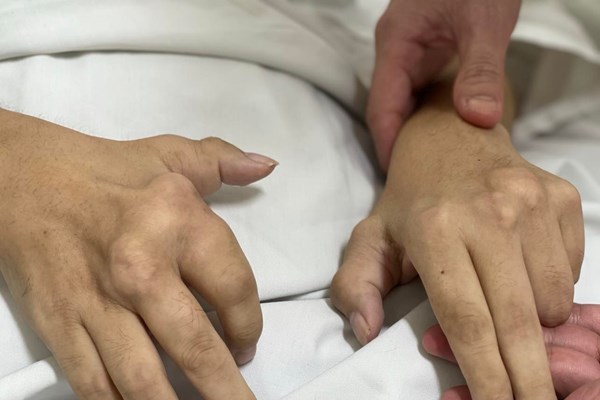 Phòng tránh bệnh gout ở người trẻ - Anh 1