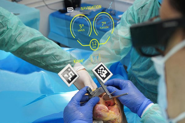 Lần đầu tiên sử dụng công nghệ “Mắt thần” trong thay khớp nhân tạo tại Việt Nam và Đông Nam Á - Anh 1