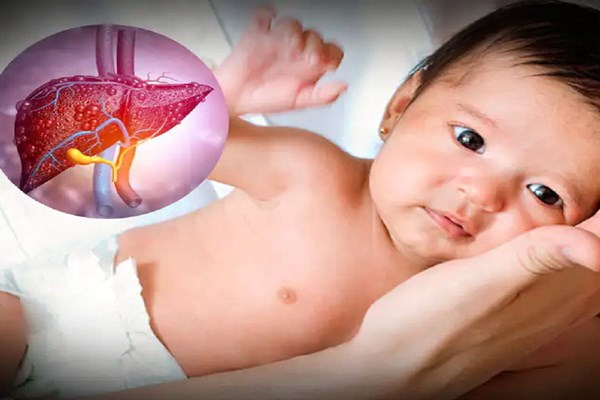 Cảnh giác với bệnh viêm gan “bí ẩn” ở trẻ em - Anh 1