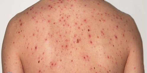 Nguy cơ tử vong khi làm đẹp tại cơ sở spa không có chuyên môn hồi sức cấp cứu - Anh 1