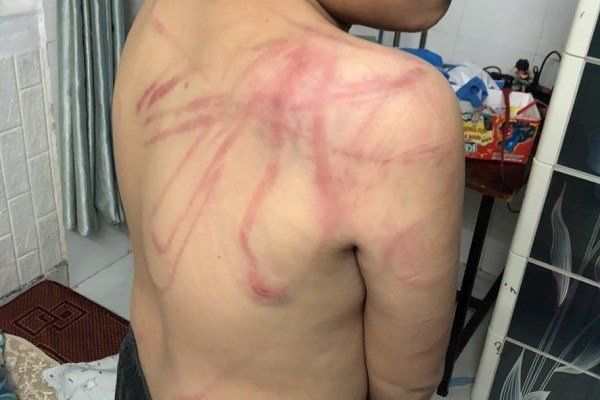 Lâm Đồng tạm giữ hình sự người cha bạo hành con ruột - Anh 1
