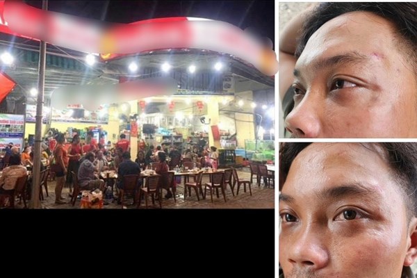 Khánh Hòa: Chỉ đạo điều tra, xử lý nhân viên quán hải sản hành hung du khách - Anh 1