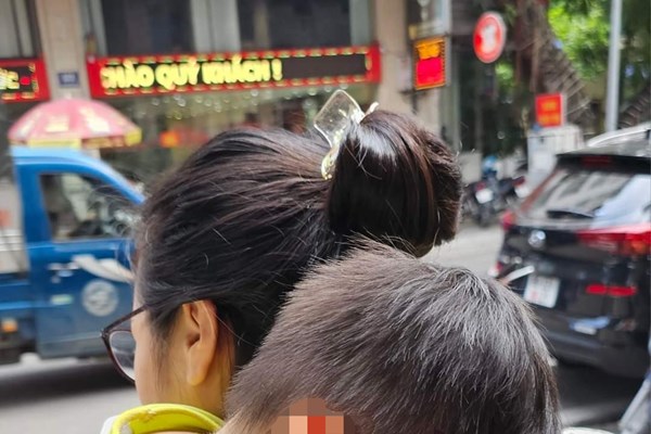 Mẹ cháu bé bị hoại tử mắt: Hy vọng mong manh - Anh 1