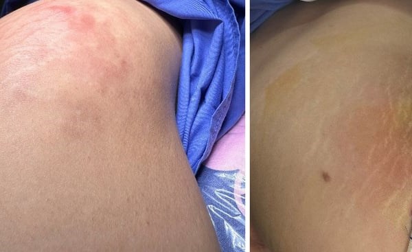 Gia tăng các ca nhập viện vì biến chứng làm đẹp đón Tết - Anh 2