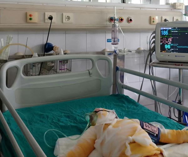 Học kỹ năng PCCC, ba cháu bé bị bỏng cồn tiên lượng nặng - Anh 1
