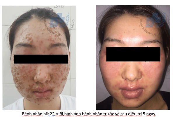 Vì sao họ cứ “điếc không sợ súng”? - Anh 1
