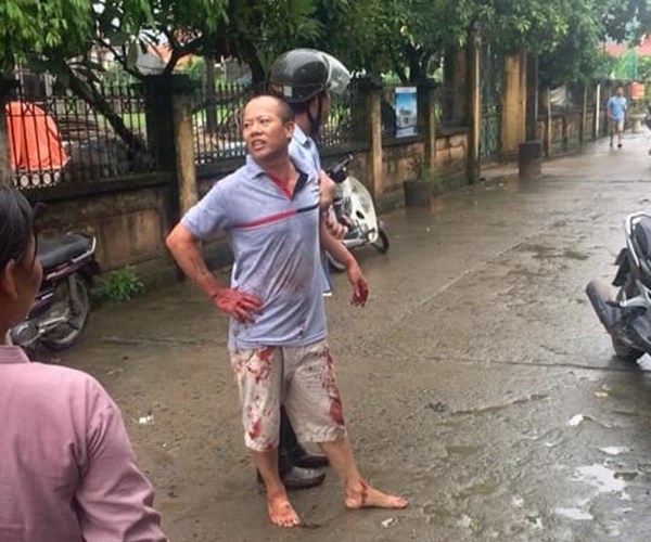 Khởi tố vụ án, bị can vụ truy sát gia đình khiến 5 người thương vong - Anh 1