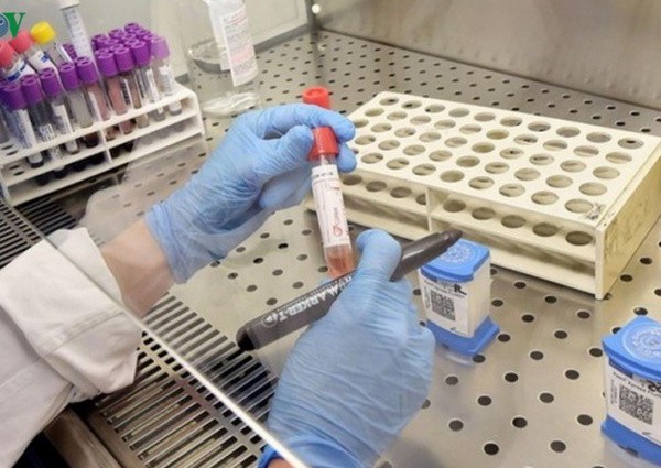 Việt Nam nghiên cứu thử nghiệm thuốc điều trị virus corona - Anh 1