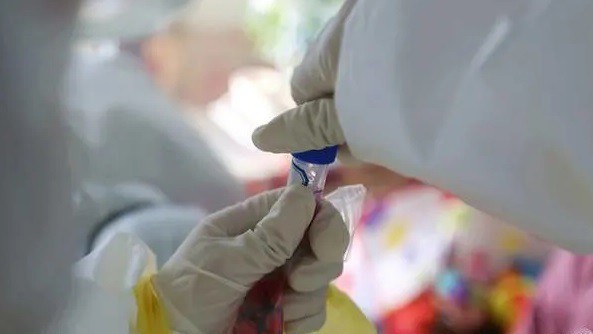 Nhật Bản thử nghiệm thành công kết hợp thuốc HIV/AIDS điều trị Covid-19 - Anh 1
